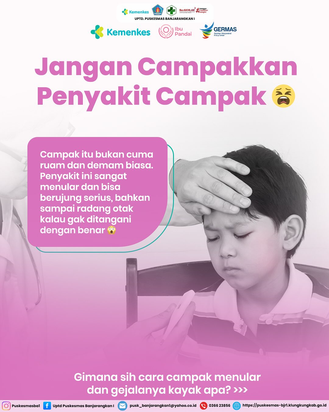 Jangan Campakkan Penyakit Campak!