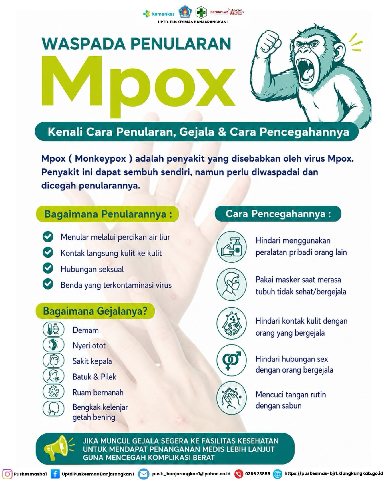 Waspada Mpox